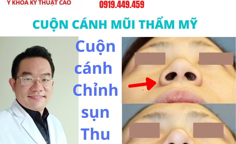 Địa chỉ khép cuộn cánh mũi Cà Mau