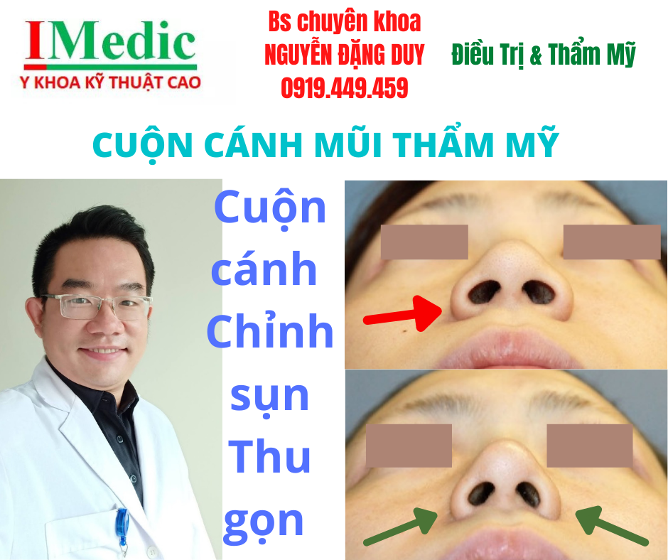 Địa chỉ khép cuộn cánh mũi Cà Mau