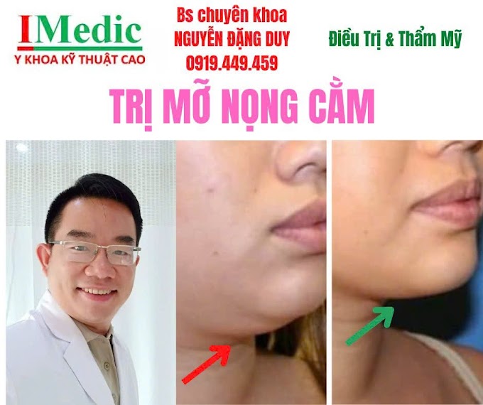Thon gọn mỡ nọng cằm Cà Mau