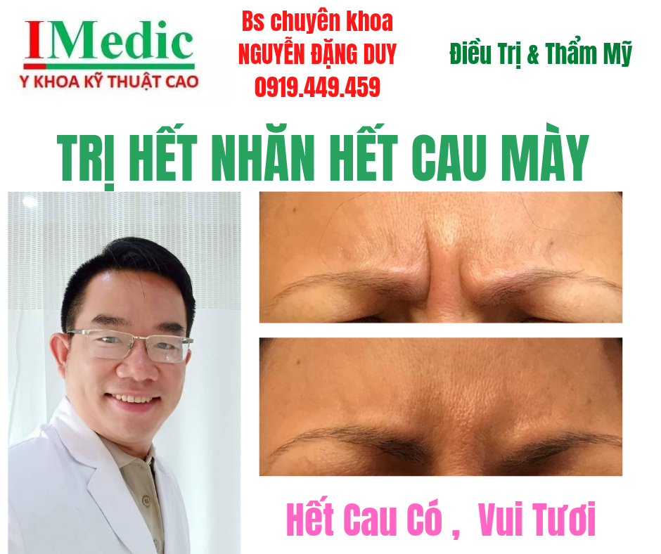 Khám phá phương pháp trị nhăn cau mày trán hiệu quả cao tại IMedic Cà Mau giúp trẻ hóa làn da an toàn dưới sự thực hiện của bác sĩ chuyên khoa.
