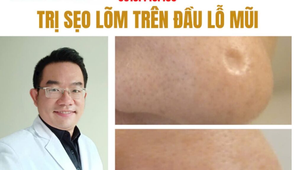 Khám phá phương pháp trị sẹo lõm cà mau an toàn, hiệu quả tận gốc tại IMedic cùng Bác sĩ Nguyễn Đặng Duy. Đặt lịch tư vấn phác đồ chuẩn y khoa ngay!