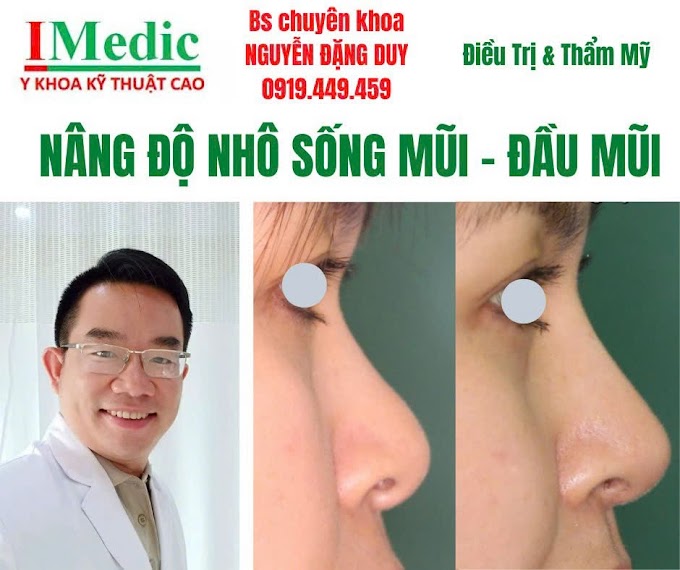 Nâng Cao Sóng Mũi Cà Mau Chuẩn Y Khoa An Toàn Tự Nhiên