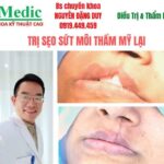 Trị sứt môi do tai nạn an toàn và hiệu quả tại Cà Mau