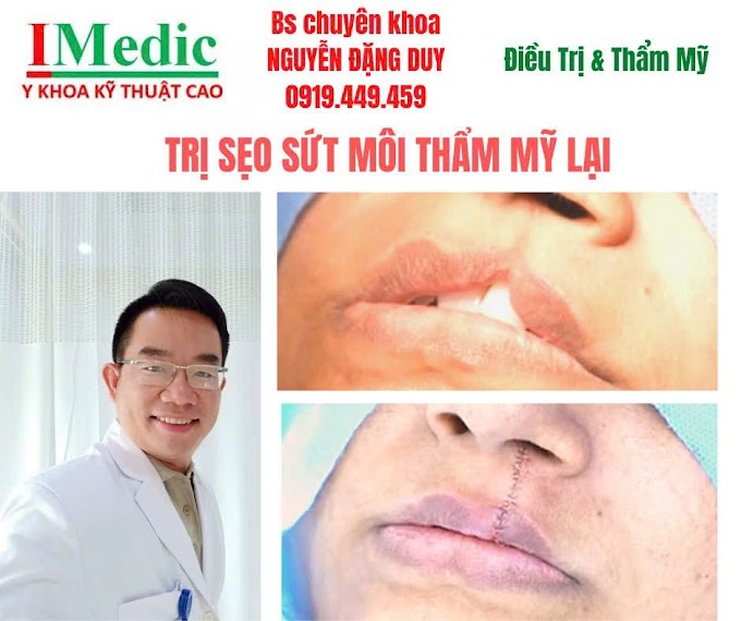 Trị sứt môi do tai nạn an toàn và hiệu quả tại Cà Mau