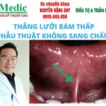 Cắt Thắng Lưỡi Bám Thấp Trẻ Em Trị Chậm Nói Cà Mau Chuẩn