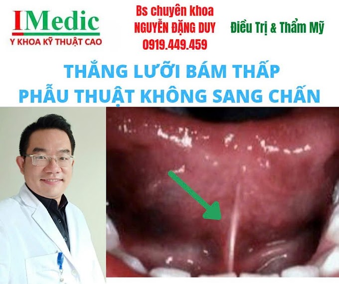 Cắt Thắng Lưỡi Bám Thấp Trẻ Em Trị Chậm Nói Cà Mau Chuẩn
