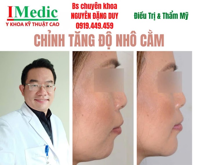 Độn Cằm Chuẩn Y Khoa An Toàn Và Tinh Tế Tại Cà Mau