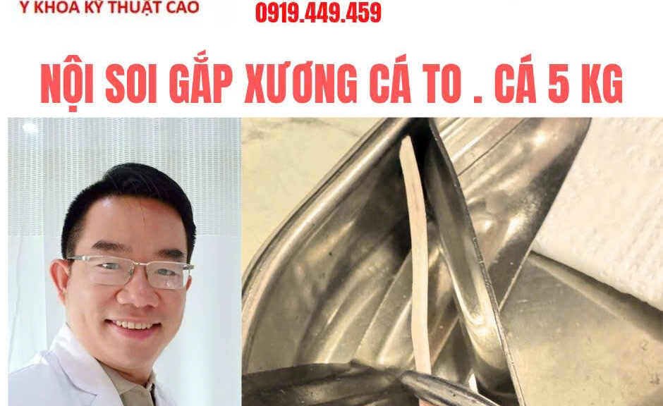 Gắp xương cá Cà Mau an toàn, không đau tại IMedic