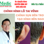 Khép lỗ tai vểnh tai dão Cà mau chuẩn y khoa an toàn