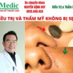Mổ Mụt Ruồi Cà Mau An Toàn Chuẩn Y Khoa Không Để Lại Sẹo IMedic 0919449459