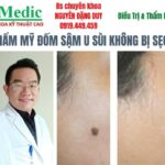 Mổ cắt nốt ruồi to lớn sùi chồi Cà Mau an toàn không sẹo