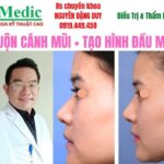 Sửa Mũi Cà Mau An Toàn Chuẩn Y Khoa Cùng Bác Sĩ Chuyên Khoa
