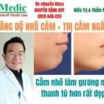 Tăng Nhô Cằm Trị Hô Cà Mau: Bí Quyết Đẹp Tự Nhiên