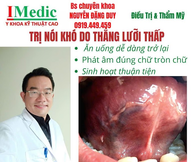 Dịch vụ phẫu thuật thắng lưỡi Cà Mau chuẩn y khoa, nhanh chóng, không đau bởi Bác sĩ Nguyễn Đặng Duy. Đặt lịch tư vấn ngay tại IMedic.