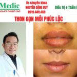 Thu Gọn Môi Dày Cà Mau An Toàn Chuẩn Y Khoa Cùng Bác Sĩ Duy
