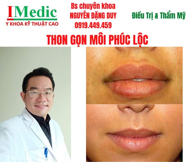 Thu Gọn Môi Dày Cà Mau An Toàn Chuẩn Y Khoa Cùng Bác Sĩ Duy