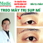 Treo cung mày Cà Mau chuẩn y khoa trẻ hóa đôi mắt