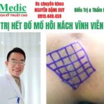 Trị Mùi Hôi Nách Cà Mau Hiệu Quả Tận Gốc Chuẩn Y Khoa