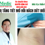 Trị hôi nách đổ mồ hôi ướt nách Cà Mau hiệu quả tận gốc