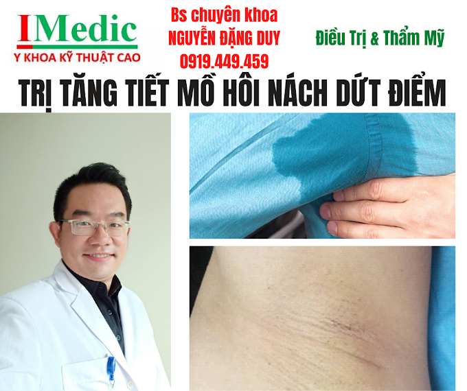 Trị hôi nách đổ mồ hôi ướt nách Cà Mau hiệu quả tận gốc