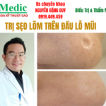 Trị Sẹo Lõm Dứt Điểm Cà Mau Chuẩn Y Khoa Tại IMedic