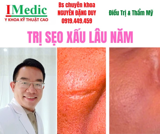 Giải pháp trị sẹo lõm do chấm thuốc phá nốt ruồi an toàn, hiệu quả cao chuẩn y khoa tại Cà Mau cùng Bác sĩ Chuyên khoa Nguyễn Đặng Duy. Xem ngay!