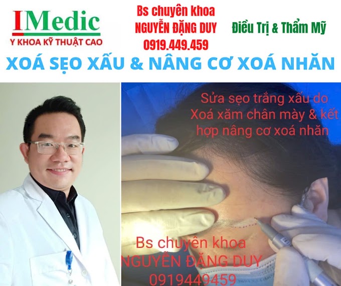 Trị Sẹo Trắng Chân Mày Do Xóa Xăm Cà Mau An Toàn Hiệu Quả