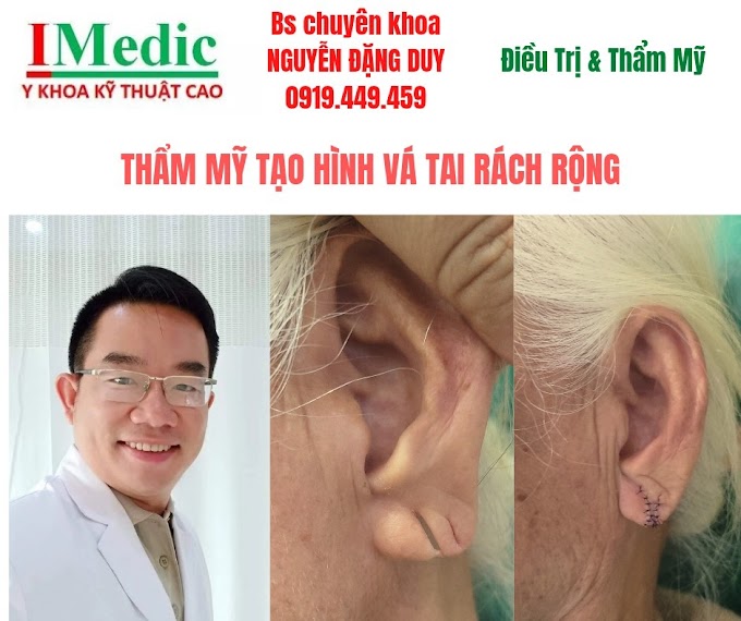 Vá lỗ tai bị giãn rách do đeo bông Cà mau ở đâu uy tín?