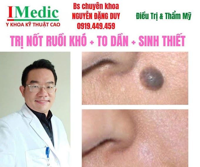 Mổ Cắt Nốt Ruồi Cà Mau An Toàn Chuẩn Y Khoa Cùng Bác Sĩ