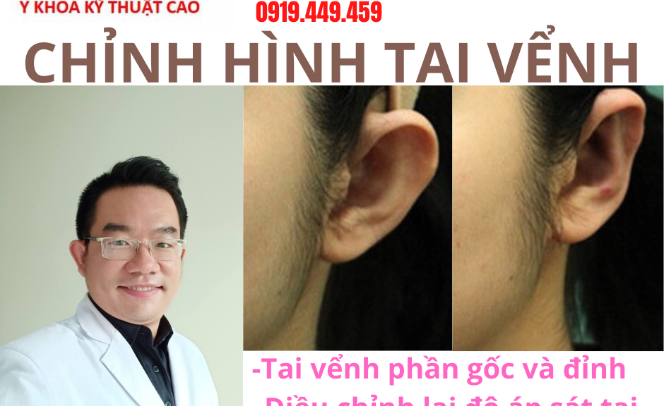 Khép Lỗ Tai Vểnh An Toàn, Tự Nhiên Tại Cà Mau