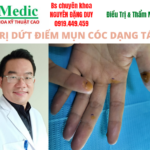 Trị mụn cóc dứt điểm tại Cà Mau bằng kỹ thuật cao an toàn
